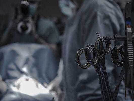 SCISSORS IN OPERATING ROOM